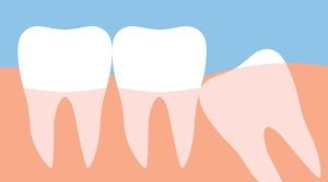 آخر لوگوں کے منہ میں عقل داڑھیں کیوں ہوتی ہیں؟