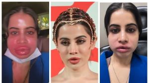 لِپ فلرز سرجری، عرفی جاوید کی نئی چونکا دینے والی ویڈیو سامنے آگئی