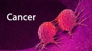 پھیپھڑوں کے کینسر کی 5 ابتدائی علامات جن کو نظر انداز نہیں کرنا چاہیے