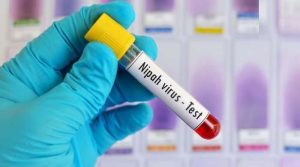 قومی ادارہ صحت نے نیپاہ وائرس کی ٹیسٹنگ کٹس حاصل کرلیں
