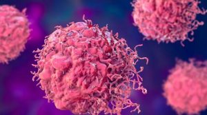 لوگوں کو کینسر جیسے مرض کا شکار بنانے والی 10 عام وجوہات