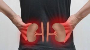 گردوں کے جان لیوا امراض سے بچنا بہت آسان