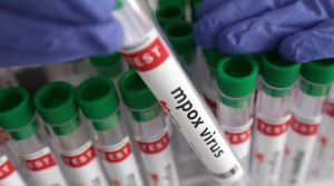 خیرپور میں منکی پاکس کی وبا کی وفاقی سطح پر تحقیقات، ماہرین کی ٹیم اسلام آباد سے روانہ